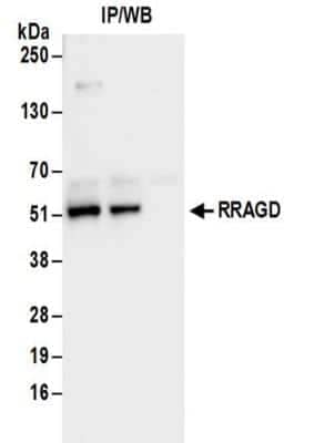 Western Blot RRAGD Antibody