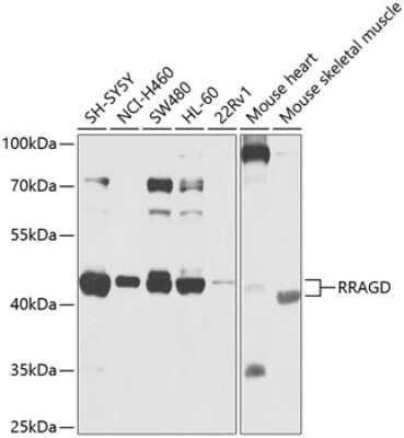 Western Blot: RRAGD Antibody [NBP2-93833] - Analysis of extracts of various cell lines, using RRAGD at 1:1000 dilution. Secondary antibody: HRP Goat Anti-Rabbit IgG (H+L) at 1:10000 dilution. Lysates/proteins: 25ug per lane. Blocking buffer: 3% nonfat dry milk in TBST. Detection: ECL Basic Kit . Exposure time: 1s.