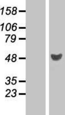 Western Blot: RRAGD Overexpression Lysate (Adult Normal) [NBP2-06538] Left-Empty vector transfected control cell lysate (HEK293 cell lysate); Right -Over-expression Lysate for RRAGD.