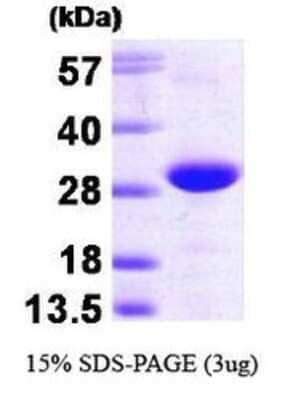 SDS-PAGE Recombinant Human TC21/R-Ras2 His Protein