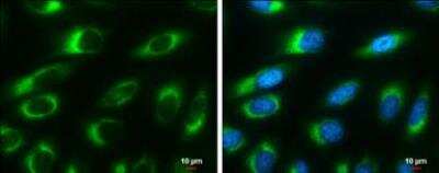 <b>Genetic Strategies Validation. </b>Immunocytochemistry/Immunofluorescence: RRBP1 Antibody (1611) [NBP2-43668] - Ribosome binding protein 1 antibody [GT1611] detects Ribosome binding protein 1 protein at endoplasmic reticulum by immunofluorescent analysis. Sample: HeLa cells were fixed in 4% paraformaldehyde at RT for 15 min. Green: Ribosome binding protein 1 stained by Ribosome binding protein 1 antibody [GT1611] diluted at 1:500. Blue: Hoechst 33342 staining. Scale bar= 10um.