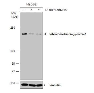 Western Blot: RRBP1 Antibody (1611) [NBP2-43668] - Non-transfected (-) and transfected (+) HepG2 whole cell extracts (30 ug) were separated by 5% SDS-PAGE, and the membrane was blotted with Ribosome binding protein 1 antibody [1611].