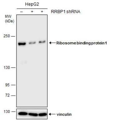 Western Blot: RRBP1 Antibody (5610) [NBP2-43600] - Non-transfected (-) and transfected (+) HepG2 whole cell extracts (30 ug) were separated by 5% SDS-PAGE, and the membrane was blotted with Ribosome binding protein 1 antibody [5610].