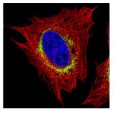 Immunocytochemistry/Immunofluorescence: RRBP1 Antibody [NBP1-32813] - Paraformaldehyde-fixed HeLa, using Ribosome binding protein 1 antibody (Green) at 1:500 dilution. Alpha-tubulin filaments (Red) at 1:500.