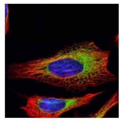 <b>Genetic Strategies Validation. </b>Immunocytochemistry/Immunofluorescence: RRBP1 Antibody [NBP1-32813] - Analysis of methanol-fixed HeLa, using Ribosome binding protein 1 antibody (Green) at 1:500 dilution. Alpha-tubulin filaments were labeled with an alpha Tubulin antibody (Red) at 1:2500.