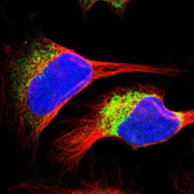 Immunocytochemistry/Immunofluorescence: RRBP1 Antibody [NBP1-83958] - Immunofluorescent staining of human cell line U-2 OS shows localization to endoplasmic reticulum.