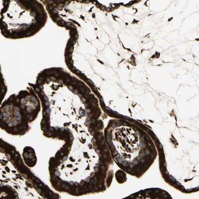 Immunohistochemistry-Paraffin: RRBP1 Antibody [NBP1-83957] - Staining of human placenta shows strong cytoplasmic positivity in trophoblastic cells.