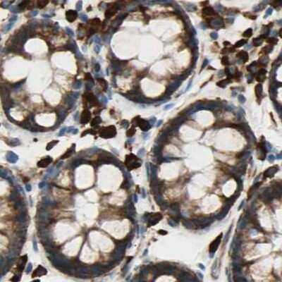 Immunohistochemistry-Paraffin: RRBP1 Antibody [NBP1-83957] - Staining of human colon.