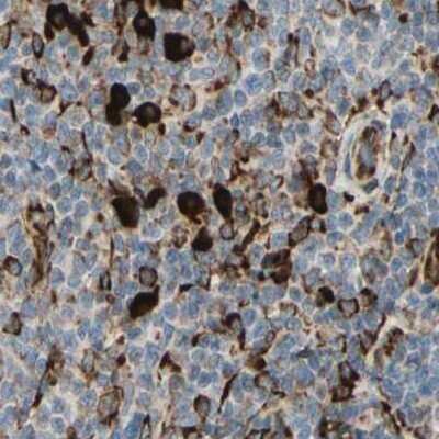 Immunohistochemistry-Paraffin: RRBP1 Antibody [NBP1-83957] - Staining of human lymph node.