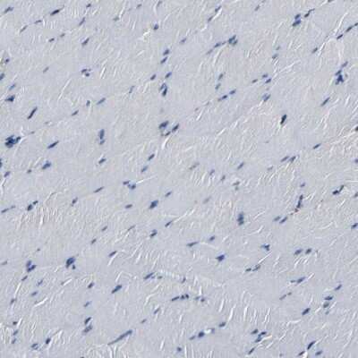 Immunohistochemistry-Paraffin: RRBP1 Antibody [NBP1-83958] - Staining of human skeletal muscle shows low expression as expected.