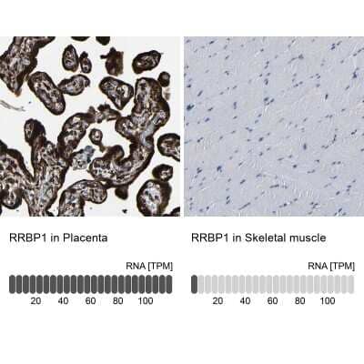 Immunohistochemistry-Paraffin: RRBP1 Antibody [NBP1-83958] - Staining in human placenta and skeletal muscle tissues using anti-RRBP1 antibody. Corresponding RRBP1 RNA-seq data are presented for the same tissues.