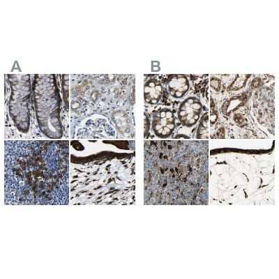 <b>Independent Antibodies Validation and Orthogonal Strategies Validation.</b>Immunohistochemistry-Paraffin: RRBP1 Antibody [NBP1-83958] - Staining of human colon, kidney, lymph node and placenta using Anti-RRBP1 antibody NBP1-83958 (A) shows similar protein distribution across tissues to independent antibody NBP1-83957 (B).