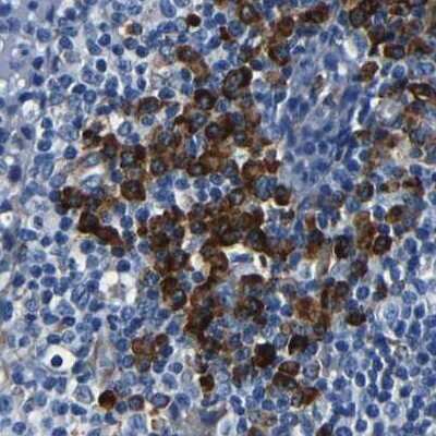 Immunohistochemistry-Paraffin: RRBP1 Antibody [NBP1-83958] - Staining of human lymph node.