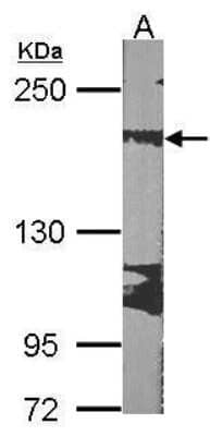 Western Blot: RRBP1 Antibody [NBP1-32813] - Sample (30 ug of whole cell lysate) A:NIH-3T3 5% SDS PAGE  diluted at 1:1000