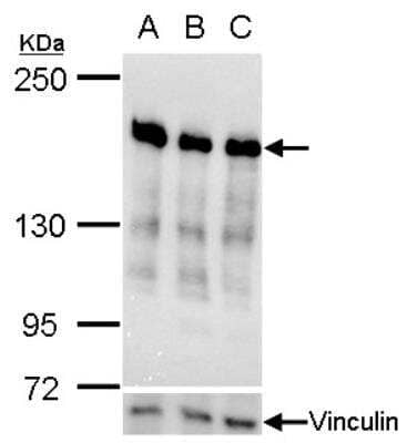 Western Blot: RRBP1 Antibody [NBP1-32813] - Ribosome binding protein 1 antibody validation by siRNA knock-down. Upper panel: Ribosome binding protein 1 antibody; Lower panel: Vinculin antibodyA. 30 ug HepG2 whole cell lysate/extractB. 30 ug whole cell lysate/extract of RRBP1 siRNA#1-transfected HepG2 cellsC. 30 ug whole cell lysate/extract of RRBP1 siRNA#2-transfected HepG2 cells5% SDS-PAGE. HRP-conjugated anti-rabbit IgG antibody was used to detect the primary antibody.