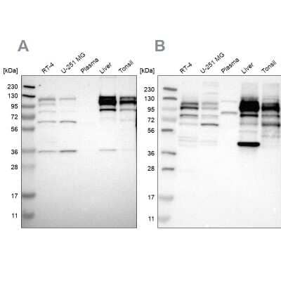 <b>Independent Antibodies Validation. </b>Western Blot: RRBP1 Antibody [NBP1-83958] - Analysis using Anti-RRBP1 antibody NBP1-83958 (A) shows similar pattern to independent antibody NBP1-83957 (B).