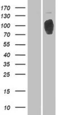 Western Blot: RRBP1 Overexpression Lysate (Adult Normal) [NBP2-07851] Left-Empty vector transfected control cell lysate (HEK293 cell lysate); Right -Over-expression Lysate for RRBP1.