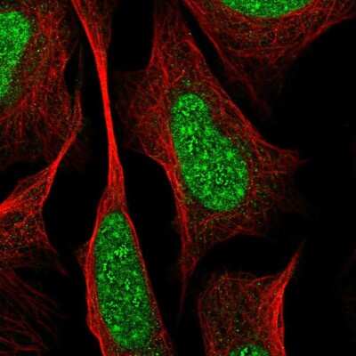 Immunocytochemistry/ Immunofluorescence RREB1 Antibody