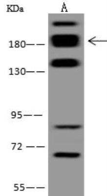 Western Blot: RREB1 Antibody [NBP3-12657] - Lane A: Hela Whole Cell LysateLysates/proteins at 30 ug per lane.SecondaryGoat Anti-Rabbit IgG (H+L)/HRP at 1/10000 dilution.Developed using the ECL technique.Performed under reducing conditions.Predicted band size:181 kDaObserved band size:181 kDa(We are unsure as to the identity of these extra bands.)