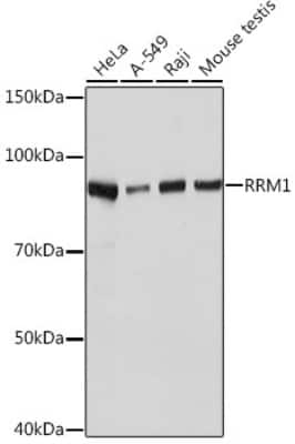 Western Blot: RRM1 Antibody (4P4U1) [NBP3-16364] - Western blot analysis of extracts of various cell lines, using RRM1 Rabbit mAb (NBP3-16364) at 1:1000 dilution. Secondary antibody: HRP Goat Anti-Rabbit IgG (H+L) at 1:10000 dilution. Lysates/proteins: 25ug per lane. Blocking buffer: 3% nonfat dry milk in TBST. Detection: ECL Basic Kit. Exposure time: 5s.