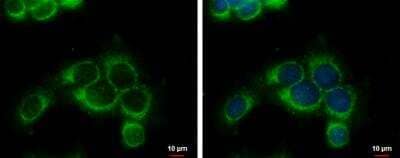 Immunocytochemistry/Immunofluorescence: RRM1 Antibody [NBP2-20231] - Green: RRM1 protein stained by RRM1 antibody. Blue: Hoechst 33342 staining.