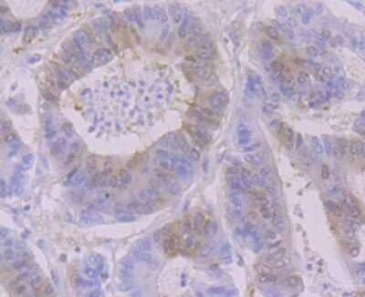Immunohistochemistry-Paraffin: RRM1 Antibody (JB09-43) [NBP2-75650] - Analysis of paraffin-embedded human colon tissue tissue using anti-RRM1 antibody. Counter stained with hematoxylin.