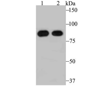 Western Blot: RRM1 Antibody (JB09-43) [NBP2-75650] - Analysis of RRM1 on mouse thymus tissue (1) and A431 cell (2) lysate using anti-RRM1 antibody at 1/500 dilution.