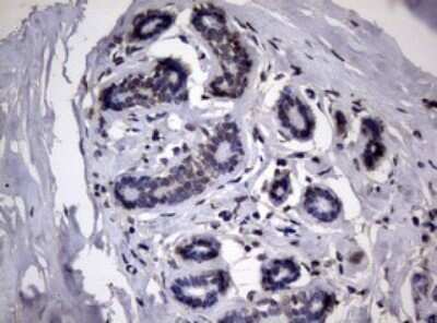 Immunohistochemistry: RRM1 Antibody (OTI5G5) - Azide and BSA Free [NBP2-73947] - Analysis of Human breast tissue. (Heat-induced epitope retrieval by 10mM citric buffer, pH6.0, 120C for 3min)