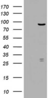 Western Blot: RRM1 Antibody (OTI5G5) - Azide and BSA Free [NBP2-73947] - Analysis of HEK293T cells were transfected with the pCMV6-ENTRY control (Left lane) or pCMV6-ENTRY RRM1.