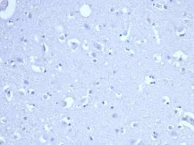 Immunohistochemistry-Paraffin: RRM1 Antibody (RRM1/4372R) [NBP3-07567] - IHC analysis of formalin-fixed, paraffin-embedded human brain. Negative tissue control using RRM1 antibody (RRM1/4372R) at 2ug/ml in PBS for 30min RT. HIER: Tris/EDTA, pH9.0, 45min. 2 : HRP-polymer, 30min. DAB, 5min.