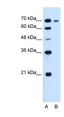 Western Blot: RRM1 Antibody [NBP1-58187] - HepG2 cell lysate, concentration 1.25ug/ml.