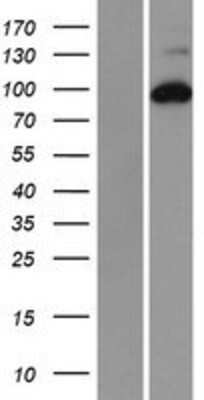 Western Blot: RRM1 Overexpression Lysate (Adult Normal) [NBP2-08619] Left-Empty vector transfected control cell lysate (HEK293 cell lysate); Right -Over-expression Lysate for RRM1.