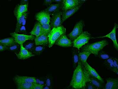 Immunocytochemistry/Immunofluorescence: RRM2 Antibody [NBP2-97629] - Immunofluorescence staining of RRM2 in U2OS cells. Cells were fixed with 4% PFA, permeabilzed with 0.1% Triton X-100 in PBS, blocked with 10% serum, and incubated with rabbit anti-Human RRM2 polyclonal antibody (dilution ratio 1:200) at 4C overnight. Then cells were stained with the Alexa Fluor(R)488-conjugated Goat Anti-rabbit IgG secondary antibody (green) and counterstained with DAPI (blue).Positive staining was localized to Cytoplasm.