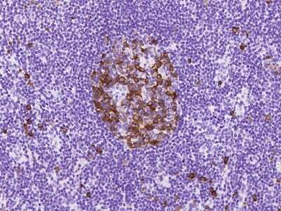 Immunohistochemistry-Paraffin: RRM2 Antibody [NBP2-97629] - Immunochemical staining of human RRM2 in human lymph node with rabbit polyclonal antibody at 1:1000 dilution, formalin-fixed paraffin embedded sections.