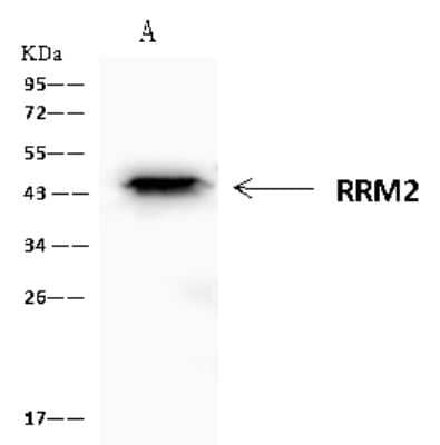 Immunoprecipitation: RRM2 Antibody [NBP2-97629] - RRM2 was immunoprecipitated using: Lane A: 0.5 mg Jurkat Whole Cell Lysate 4 ul anti-RRM2 rabbit polyclonal antibody and 60 ug of Immunomagnetic beads Protein A/G.  Primary antibody: Anti-RRM2 rabbit polyclonal antibody, at 1:100 dilution. Secondary antibody: Clean-Blot IP Detection Reagent (HRP) at 1:1000dilution. Developed using the ECL technique. Performed under reducing conditions. Predicted band size: 45 kDa. Observed band size: 45 kDa