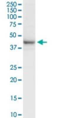 Western Blot: RRM2 Antibody [H00006241-D01P] - Analysis of RRM2 expression in human placenta.