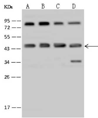 Western Blot: RRM2 Antibody [NBP2-97629] - Anti-RRM2 rabbit polyclonal antibody at 1:500 dilution. Lane A: HepG2 Whole Cell Lysate Lane B: Hela Whole Cell Lysate Lane C: K562 Whole Cell Lysate Lane D: Jurkat Whole Cell Lysate Lysates/proteins at 30 ug per lane. Secondary Goat Anti-Rabbit IgG (H+L)/HRP at 1/10000 dilution. Developed using the ECL technique. Performed under reducing conditions. Predicted band size: 45 kDa. Observed band size: 45 kDa (We are unsure as to the identity of these extra bands).