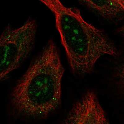 Immunocytochemistry/ Immunofluorescence RRNAD1 Antibody - BSA Free