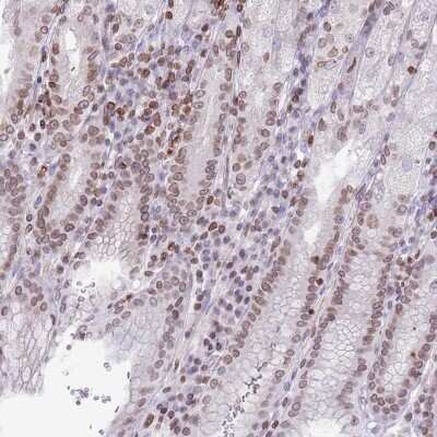 Immunohistochemistry-Paraffin RRNAD1 Antibody - BSA Free