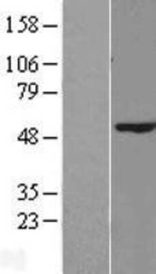 Western Blot: RRNAD1 Overexpression Lysate (Adult Normal) [NBL1-08328] Left-Empty vector transfected control cell lysate (HEK293 cell lysate); Right -Over-expression Lysate for RRNAD1.