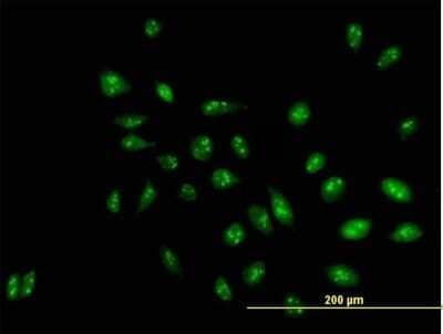 Immunocytochemistry/Immunofluorescence: RRP1 Antibody [H00008568-B01P] - Analysis of purified antibody to D21S2056E on HeLa cell. (antibody concentration 10 ug/ml)