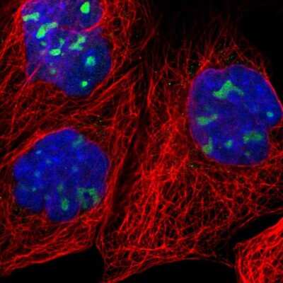 Immunocytochemistry/Immunofluorescence: RRP1 Antibody [NBP1-85339] - Staining of human cell line A-431 shows localization to nucleoli. Antibody staining is shown in green.
