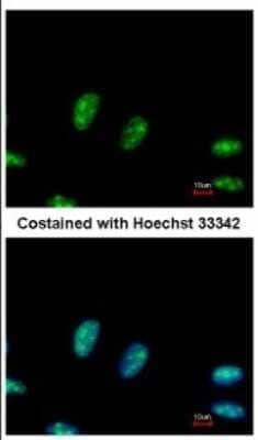 Immunocytochemistry/Immunofluorescence: RRP1 Antibody [NBP2-20233] - Immunofluorescence analysis of paraformaldehyde-fixed HeLa, using antibody at 1:500 dilution.