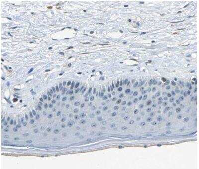 Immunohistochemistry-Paraffin RRP1 Antibody