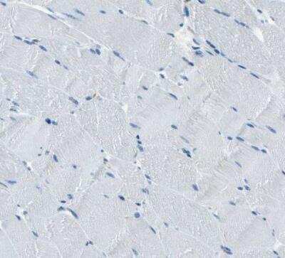 Immunohistochemistry-Paraffin: RRP1 Antibody [NBP1-85338] - Staining of human skeletal muscle shows no nucleoli positivity in monocytes.