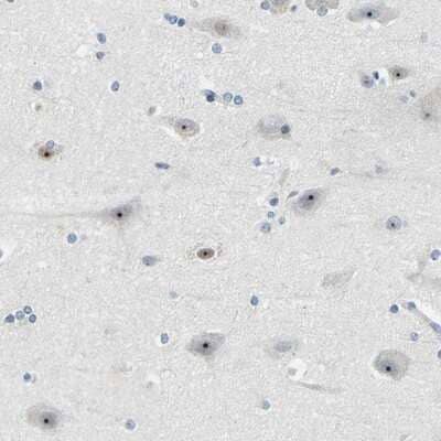 Immunohistochemistry-Paraffin: RRP1 Antibody [NBP1-85339] - Staining of human cerebral cortex shows strong nuclear(nucleolar) positivity in neuronal cells.