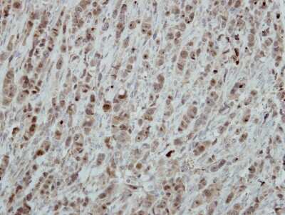 Immunohistochemistry-Paraffin: RRP1 Antibody [NBP2-20233] - Immunohistochemical analysis of paraffin-embedded MB157 xenograft, using antibody at 1:100 dilution.