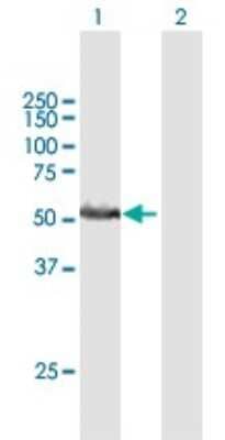 Western Blot: RRP1 Antibody [H00008568-B01P] - Analysis of RRP1 expression in transfected 293T cell line by RRP1 polyclonal antibody.  Lane 1: D21S2056E transfected lysate(50.71 KDa). Lane 2: Non-transfected lysate.