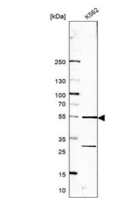 Western Blot: RRP1 Antibody [NBP1-85338] - Analysis in human cell line K562.