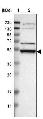 Western Blot: RRP1 Antibody [NBP1-85339] - Lane 1: Marker [kDa] 230, 130, 95, 72, 56, 36, 28, 17, 11Lane 2: Human cell line RT-4